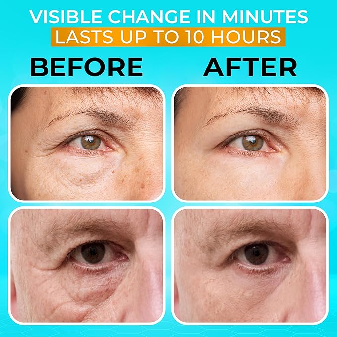 SEAMANTIKA Under Eye Cream with Collagen for Puffiness and Bags – 0.8 Fl Oz | Fast-Acting Eye Tightening Treatment for Wrinkles, Puffiness & Fine Lines | Lifts and Firms Under-Eye Area in Minutes