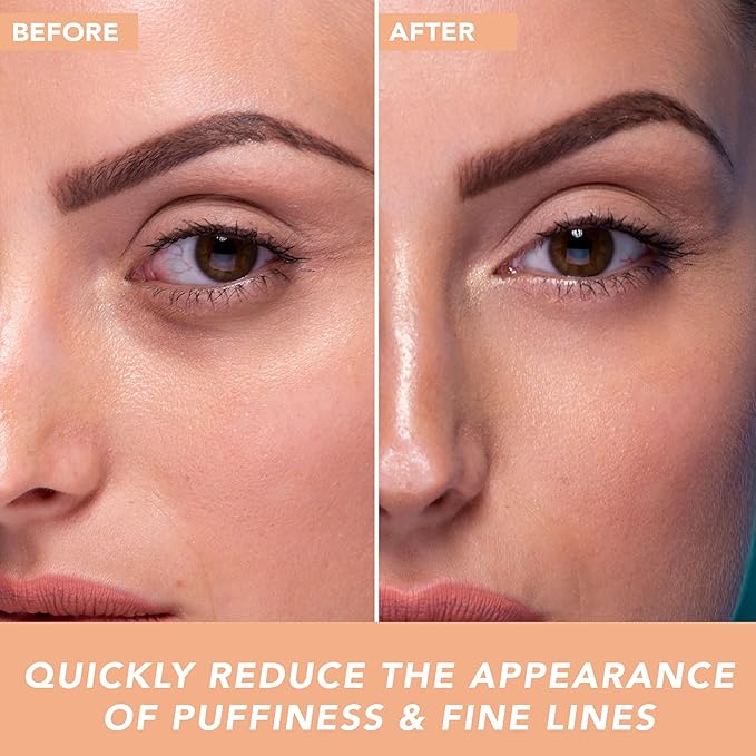 Beauty by Earth Under Eye Cream - Cooling Anti-Aging Hyaluronic Acid Eye Gel for Dark Circles, Puffiness & Wrinkles