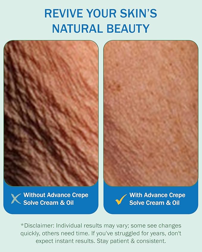 Crepe Skin Erase Cream Set (2 Pk, 4 Fl Oz each) - with Natural Oils, Licorice Root & Chamomile Extract - Crepey Skin Tightening and Firming Body Cream, Made in USA