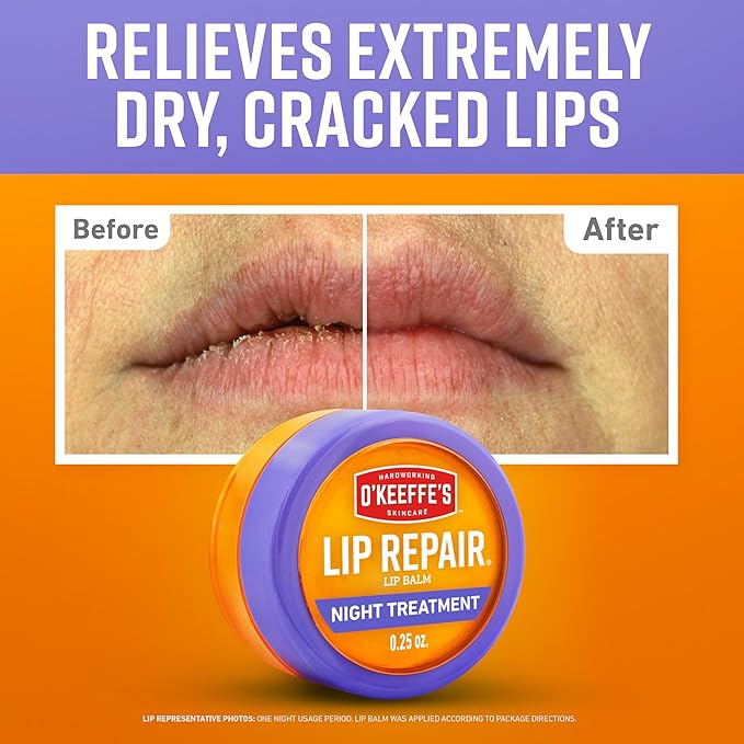 O'Keeffe's Lip Repair Night Treatment Lip Balm for Dry,Cracked Lips - 0.25 Ounce Jar - Moisturizer for Extremely Cracked,Dry Lips,(Pack of 4)