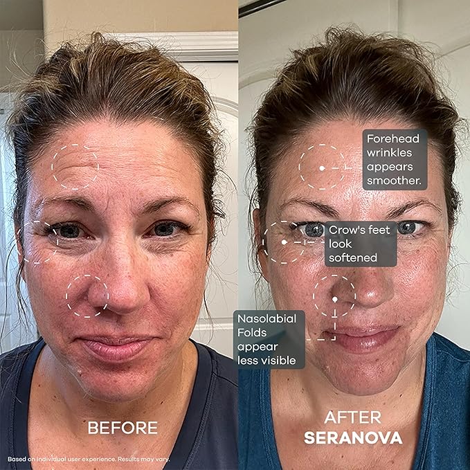 Seranova Micro Infusion for Skin Care, Facial Moisturizing Essence, Serum Smooth Skin Facial Serum for All Skin Types, 1-Month Supply